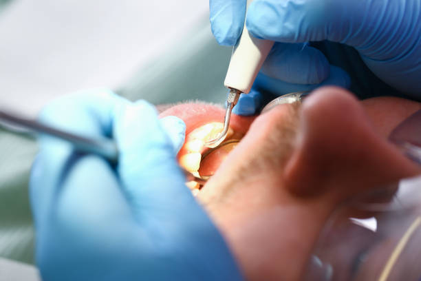 Best Knocked-Out Tooth Emergency  in Parks, AZ
